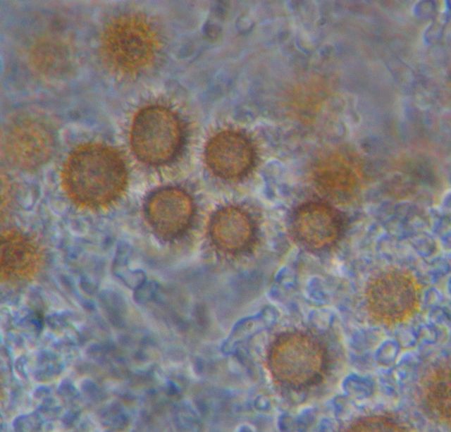 Scleroderma cepa sporer 2.jpg