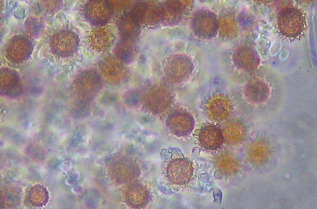 Scleroderma cepa sporer 1.jpg